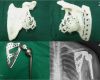 3d Druck Nach Vorlage Genial Rekonstruktion Mit Dem 3d Drucker 3d Druck Magazin