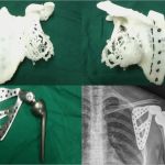 3d Druck Nach Vorlage Genial Rekonstruktion Mit Dem 3d Drucker 3d Druck Magazin