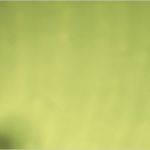 Aok Impfungen Kostenübernahme Vorlage Erstaunlich Osteopathie Kosten