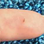 Erstunterweisung Bei Neueinstellung Vorlage Genial Tierchen Wie Flöhe In Der Wonung Wohnung Ungeziefer