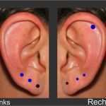 Hose Nach Vorlage Schneidern Lassen Bewundernswert 5 Ohrlöcher Aufeinmal Stechen Gesundheit Ohrloch Pircen