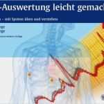 Klinische Bewertung Vorlage Schön Ekg Auswertung Leicht Gemacht Von Sybille Klinge Rainer