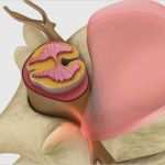 Kundenfeedback Vorlage Luxus 42 Erstaunlich Befund Physiotherapie Vorlage Foto