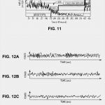 Patentbeschreibung Vorlage Wunderbar Patent Ep B1 Nachweis Des Schlafstadiums Google