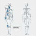 Physiotherapie Befund Vorlage Großartig Schmerzen Hypnose München