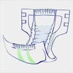 Seni Man Super Vorlagen Elegant Inkontinenzslip Super Seni Trio Small Ve 10 Stück