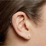 Verlustmeldung Hörgerät Krankenkasse Vorlage Erstaunlich Hörgeräte