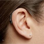 Verlustmeldung Hörgerät Krankenkasse Vorlage Schön Hörgeräte