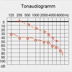 Verlustmeldung Hörgerät Vorlage Erstaunlich Gewöhnung An Hörgeräte so Gelingt Eingewöhnung