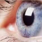 Vorlage Kündigung Berufsunfähigkeitsversicherung Inspiration Arbeitsrecht Urteile Mit E Rechtsanwälte Kotz