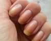 Vorlagen Für Gelnägel Wunderbar Nageldesign Naturnagel