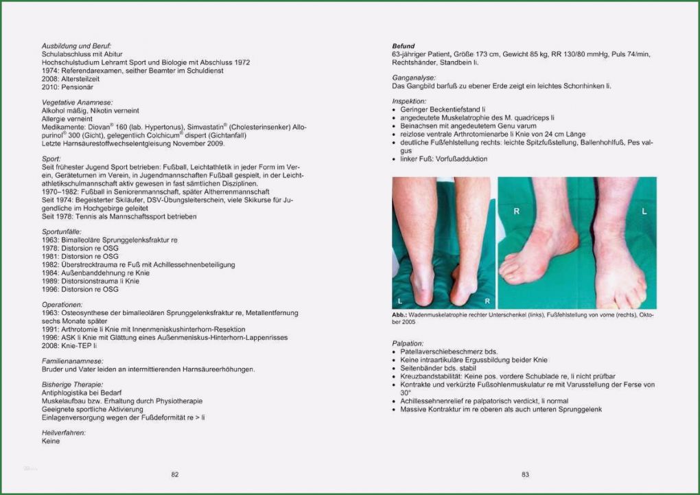 Physiotherapie Befund Vorlage Best Of Befund Physiotherapie Vorlage Neu Ziemlich Bewegung
